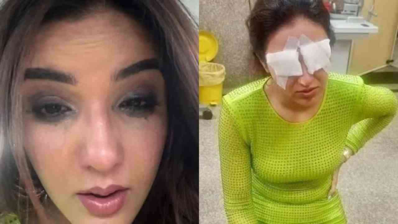 लेंस लगाने के बाद Jasmine Bhasin की आंखें हुई खराब!, एक्ट्रेस बोली-  दर्द सहना मुश्किल...
